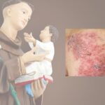 Fuoco di Sant’Antonio: segnare o curare? Cosa fare davvero